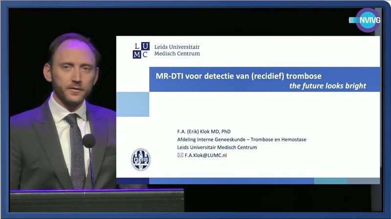 MR-DTI voor detectie van (recidief) trombose
